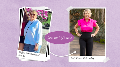 Before and after of Lori Thomas who lost 57 lbs using a plan from Dr. Haver for inflammaging and weight loss