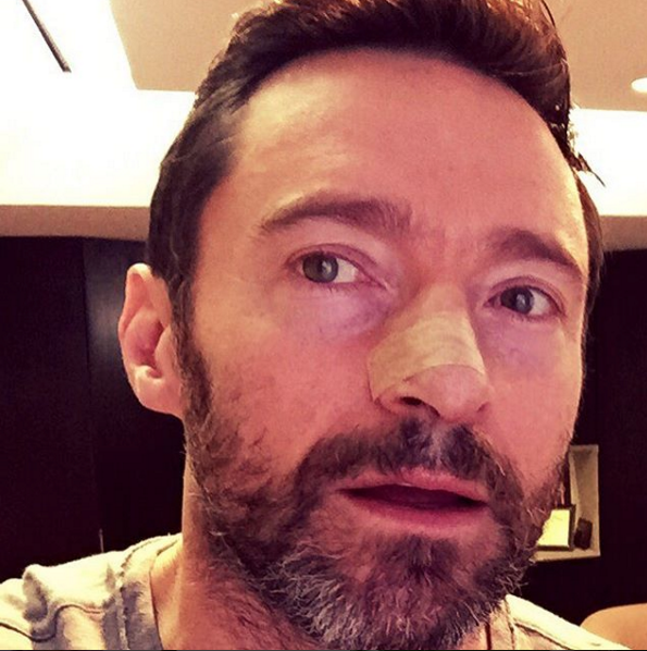 Hugh Jackman