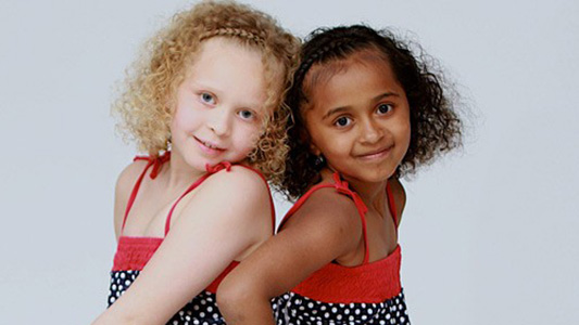 12 Photos of Twins Who Have Shockingly Different Features