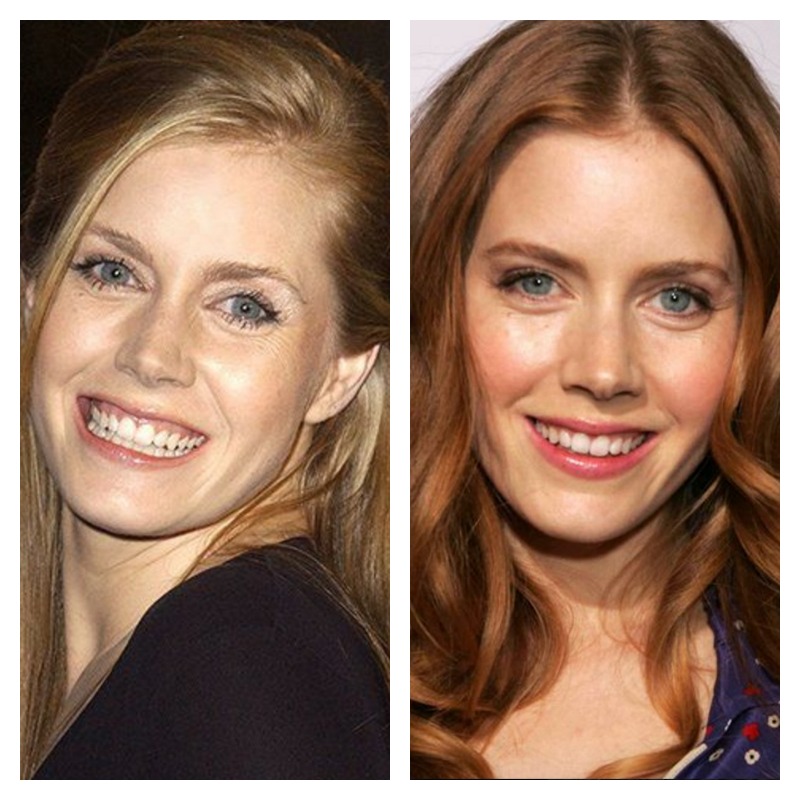 Celebs Better Red Hair Amy Adams