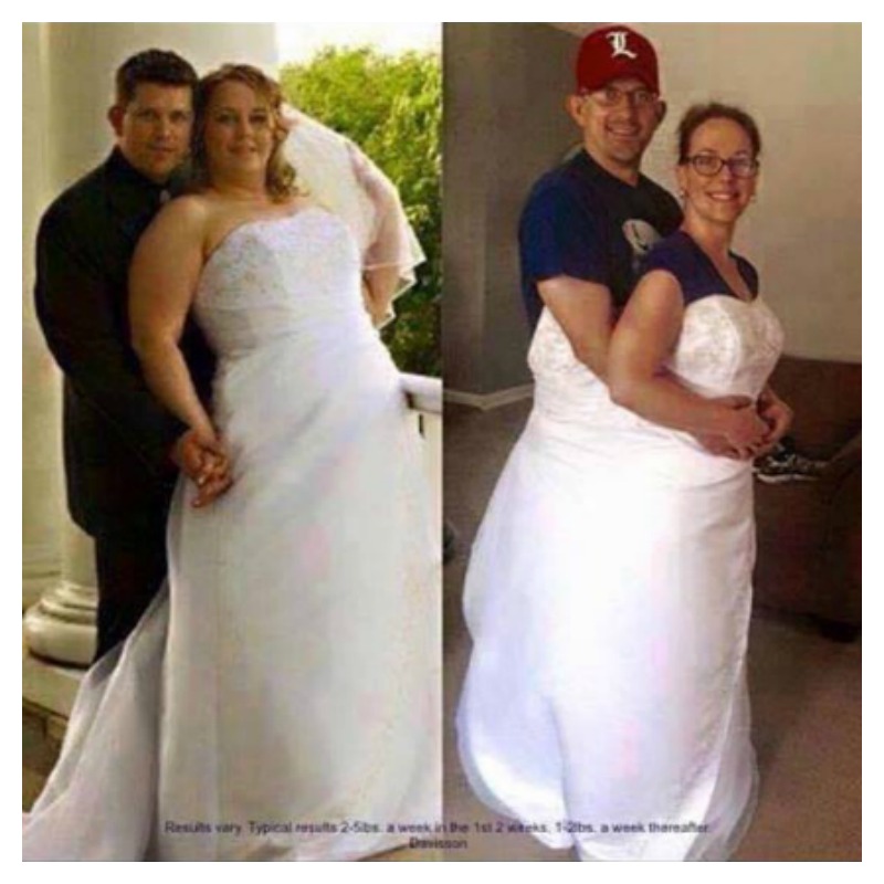 Weight Loss Before And After Both Fit