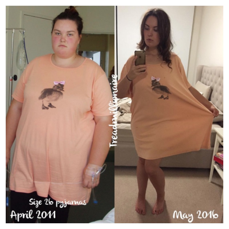 Weight Loss Transformations 1
