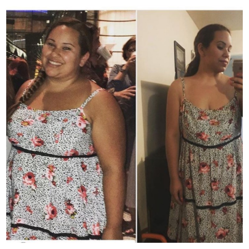 Weight Loss Transformations 3