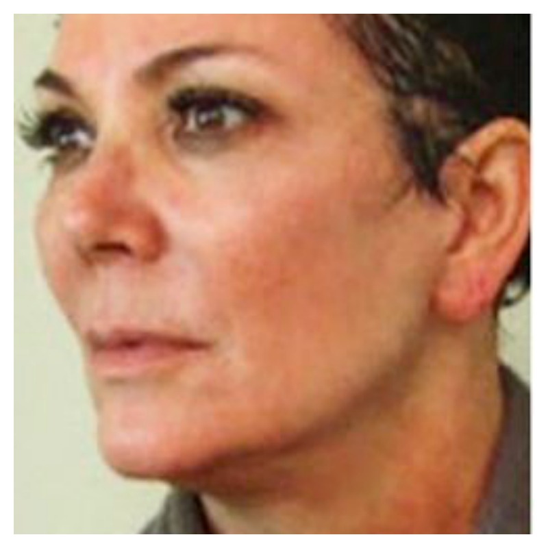 Celebrities Without Makeup Kris Jenner