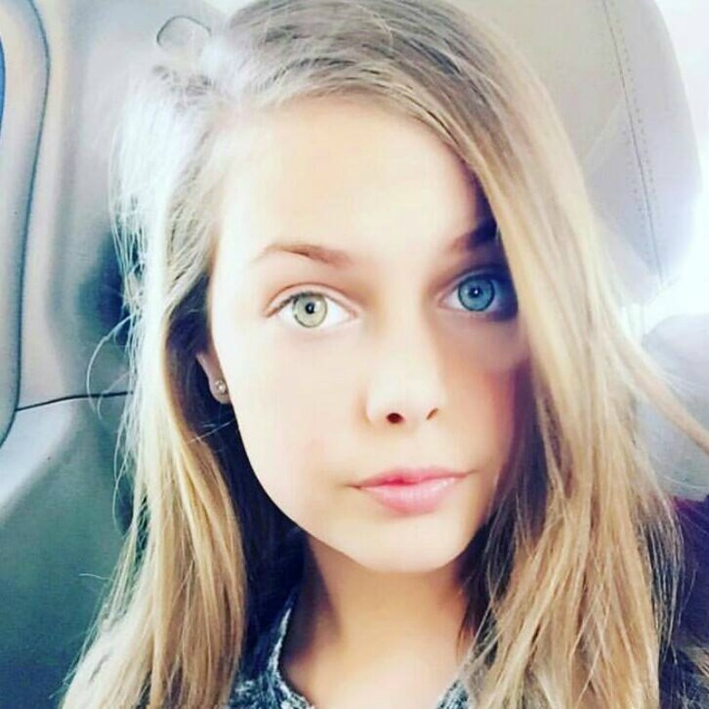 Different Colored Eyes 11