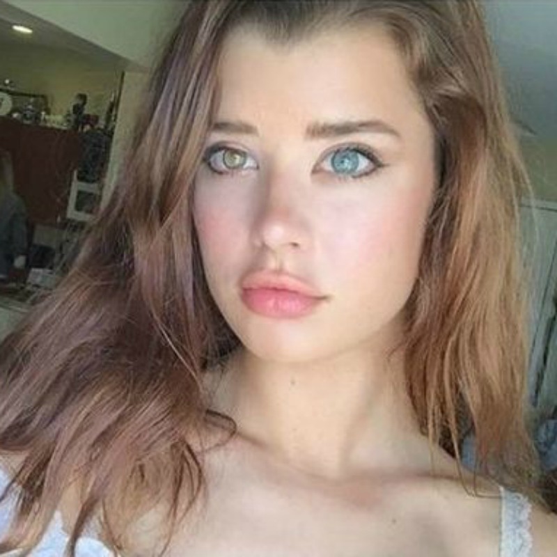 Different Colored Eyes 6