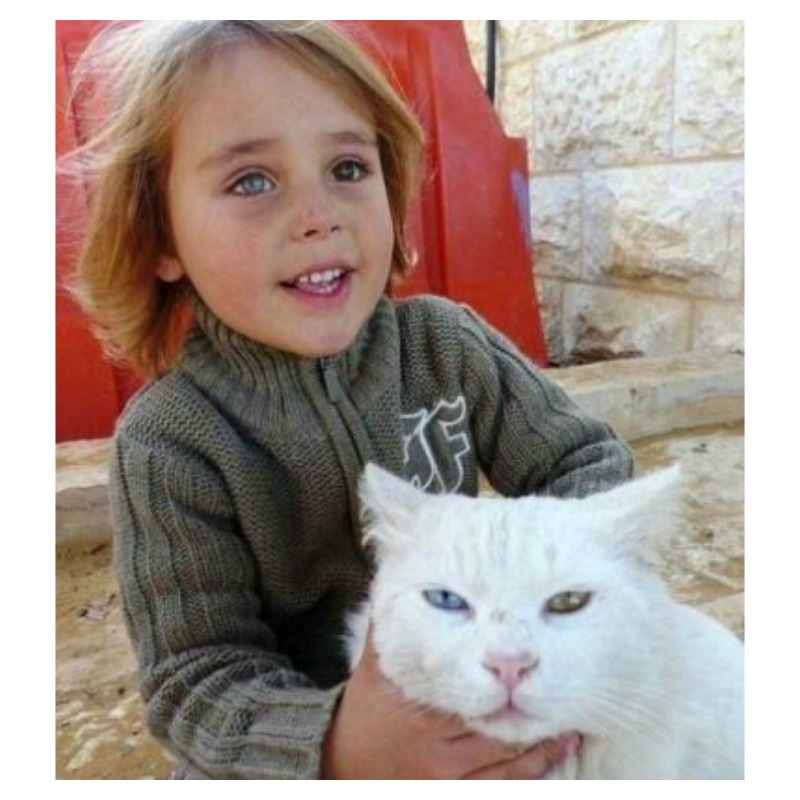 Different Colored Eyes Boy With Cat