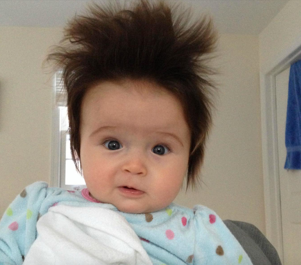 babies born with tons of hair