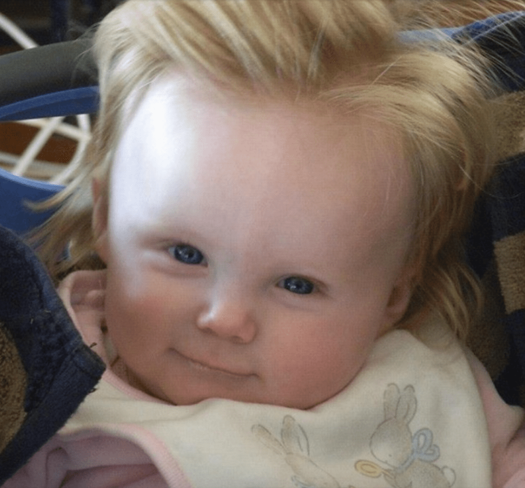 babies born with tons of hair conan