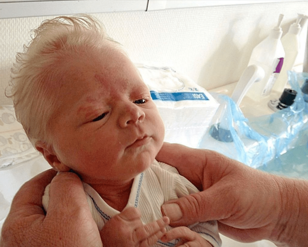 babies born with tons of white
