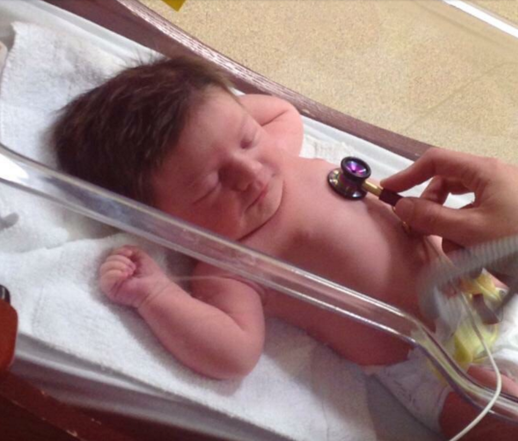 babies born with tons of hair newborn