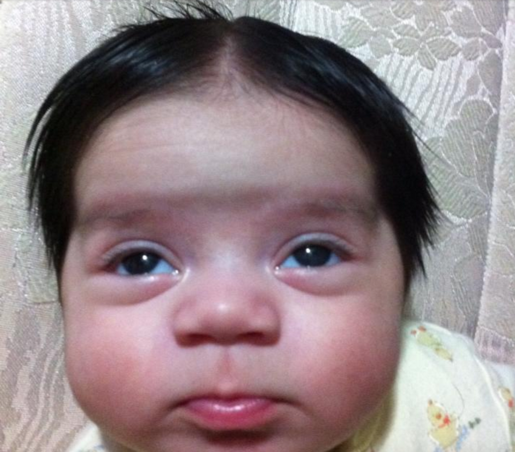 babies born with tons of hair dark