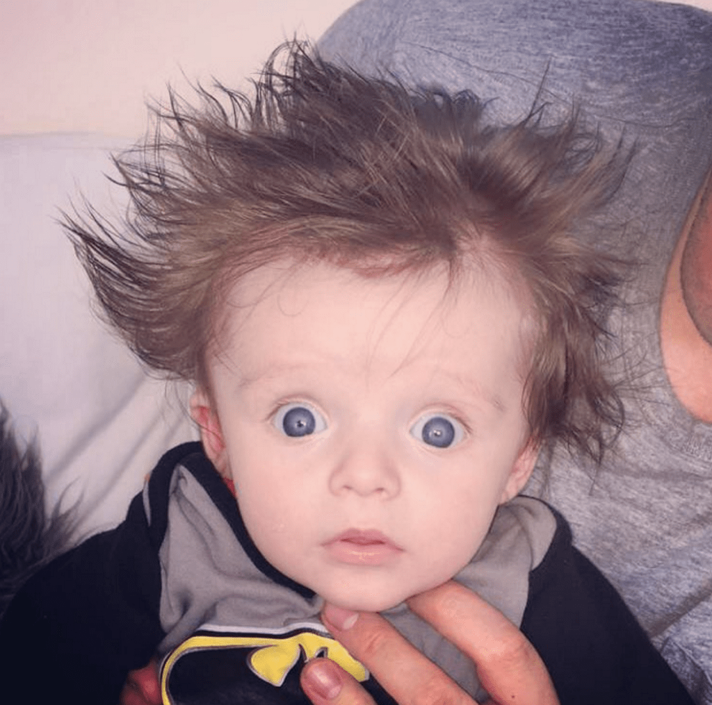 babies born with tons of hair bad hair day