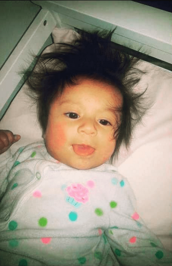 babies born with tons of hair dark