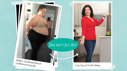 Before and after Lisa Brounstein who lost 150 lbs with no loose skin