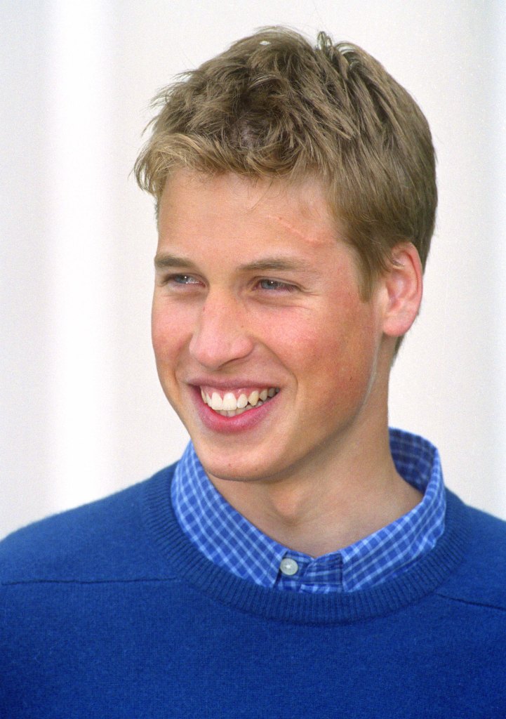 prince william scar