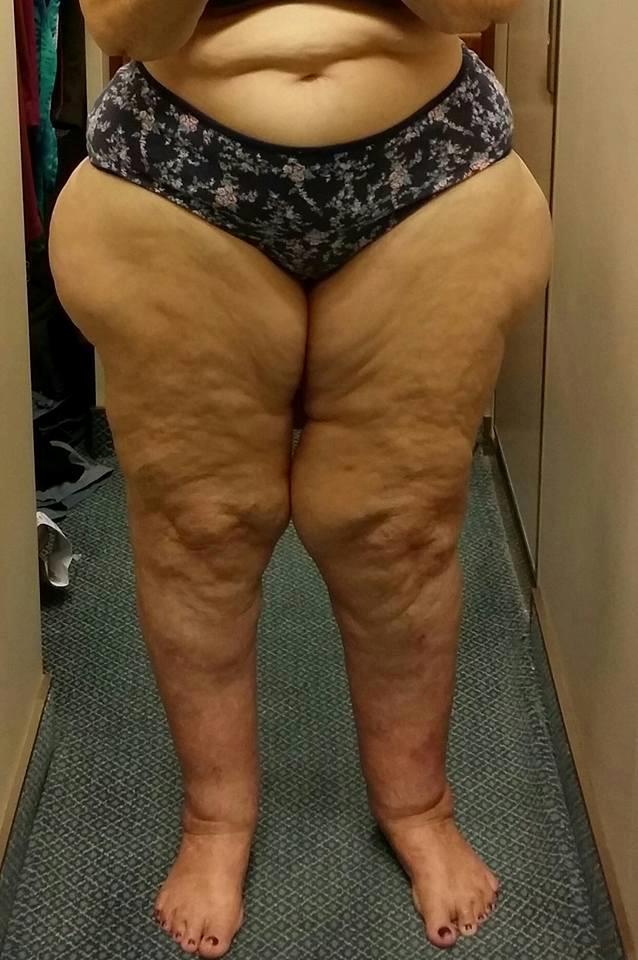 Elizabeth Ayres Legs