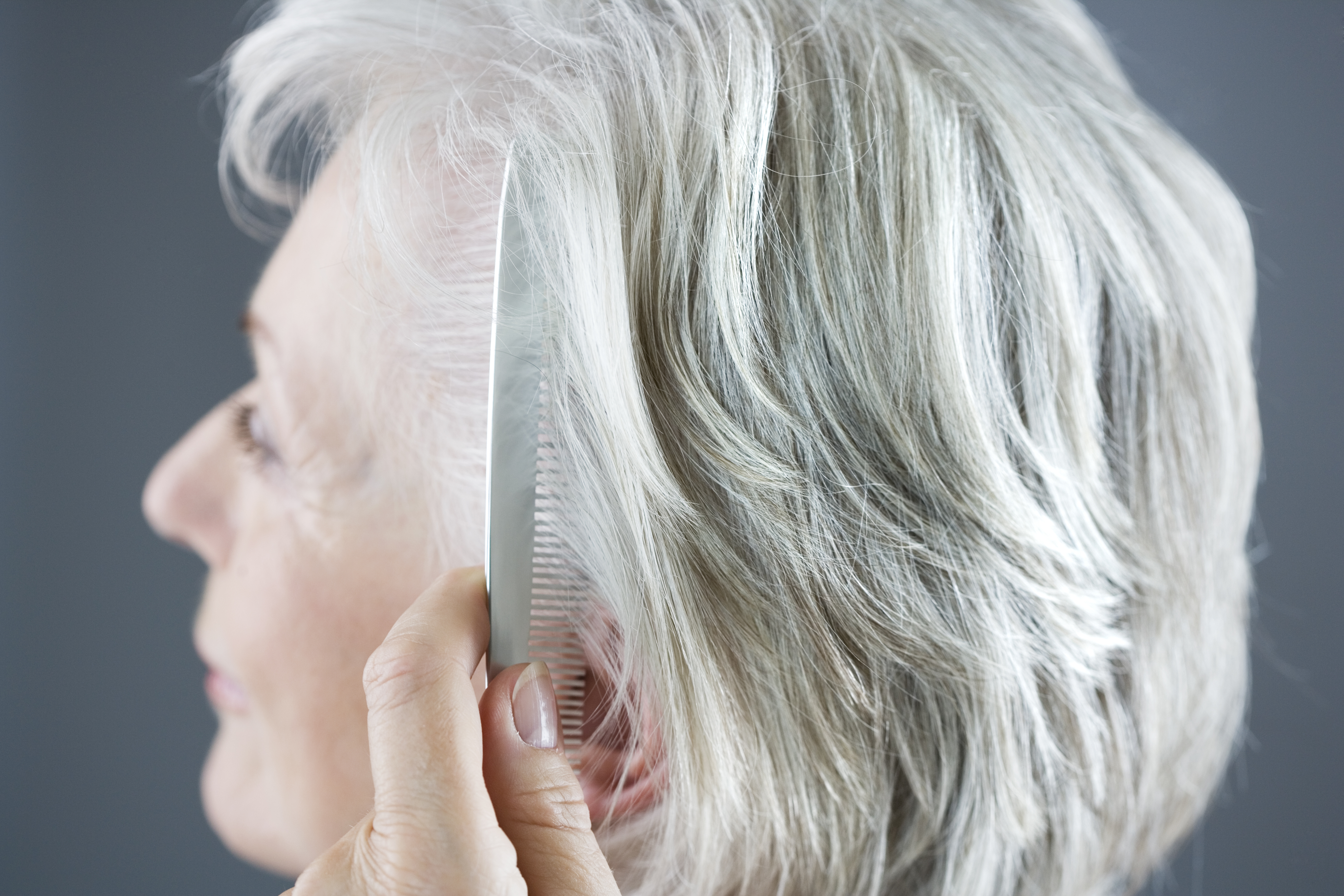 Seasonal Hair Loss Is the Reason You're Losing Hair in Winter — But It's  Totally Normal