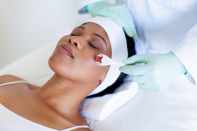 woman lying back with a white handband on as she receives a microneedling treatment