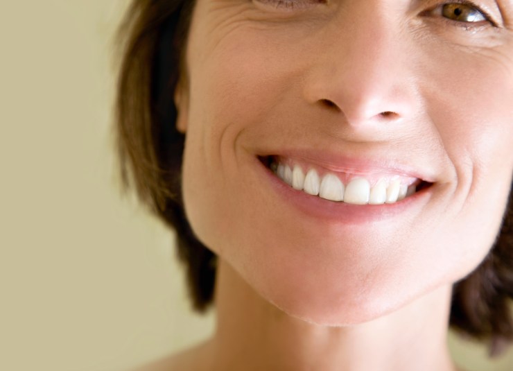 Woman in her 40s smiling with white teeth.
