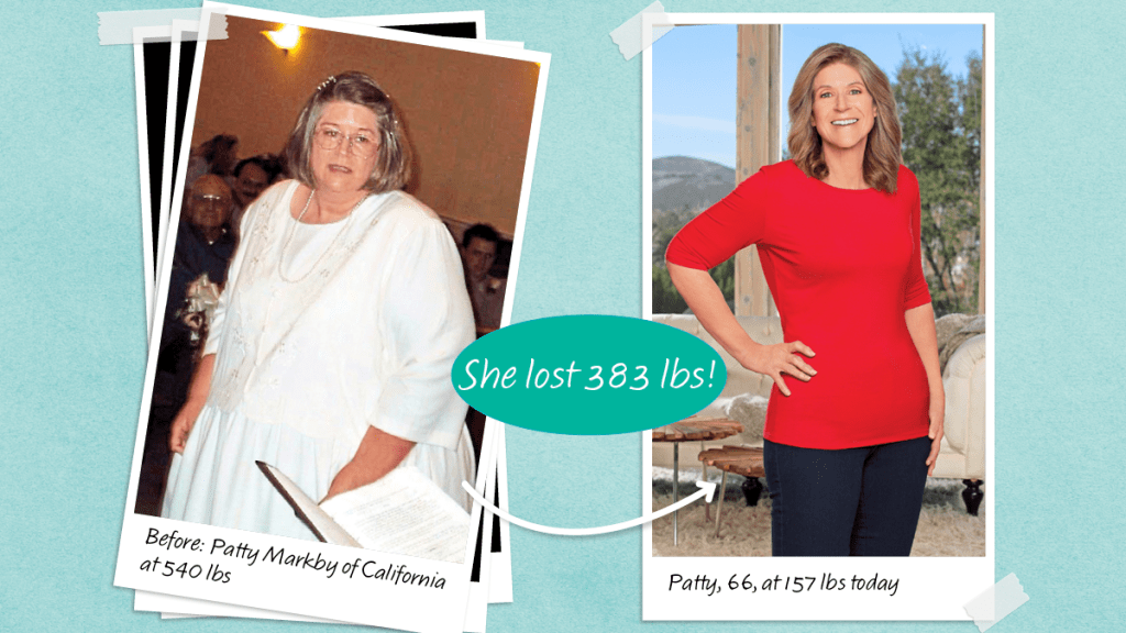 Before and after photos of Patty Markby who lost 383 lbs on Whole30, an anti inflammatory diet for weight loss and healing