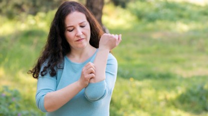 Woman itching bug bite