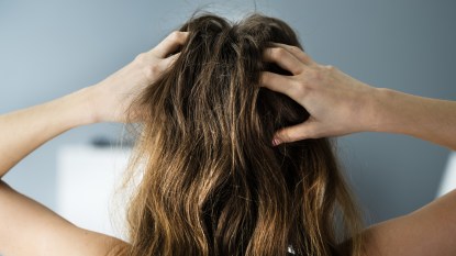 Woman with itchy scalp