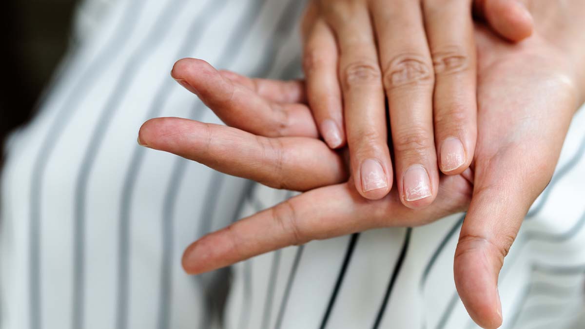 What nail disorders say about your health | FMT