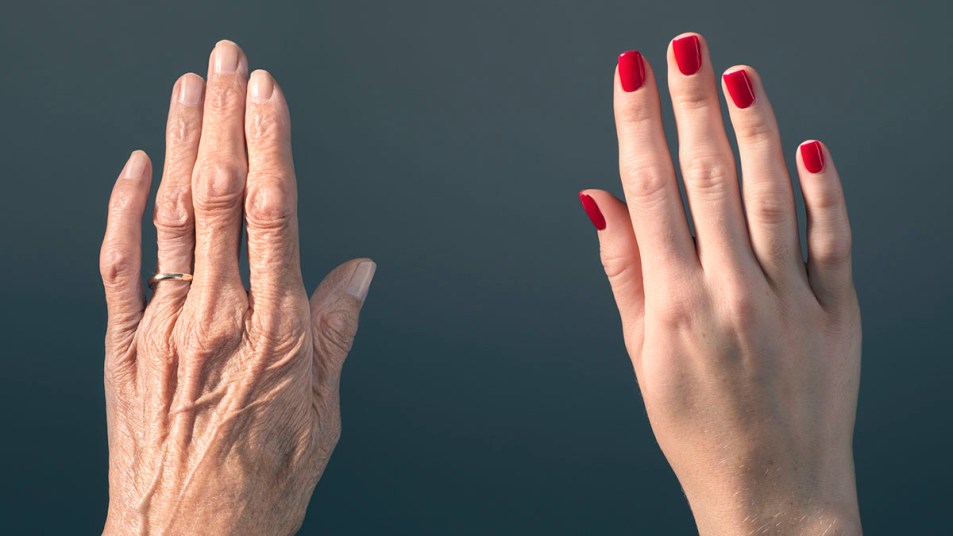 Two different hands are pictured side by side, one older and wrinkled wearing a wedding ring and the other young with red fingernails.