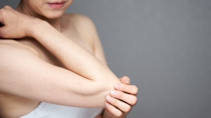 woman smoothing her dry elbows