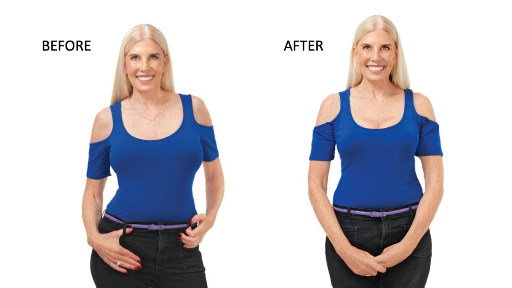 Cherie Corso, 52, before and after a new bra