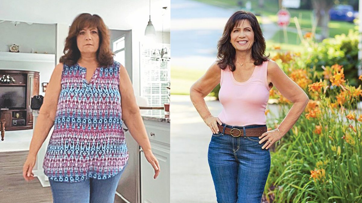 Leslie Mayorga vor und nach Gewichtsverlust