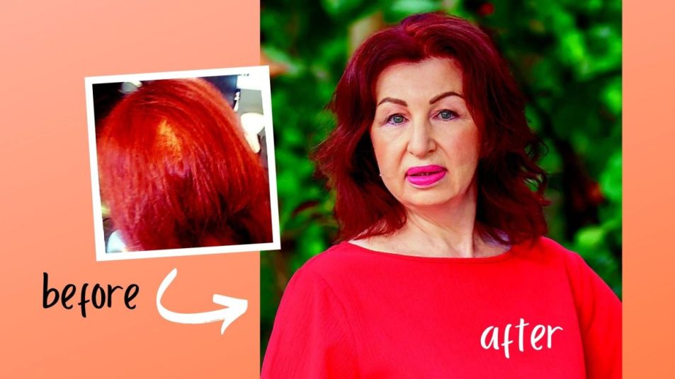 Valentina Karanfilian, woman who suffered from hair loss and took a supplement