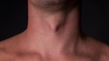 Close up of Adam's apple in a white man's neck