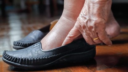 mature woman putting on a pair of leather dress shoes, swollen feet