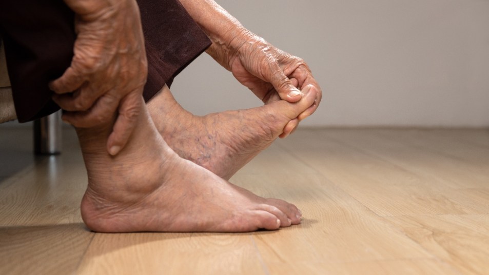 mature woman rubbing foot because of gout flare-ups