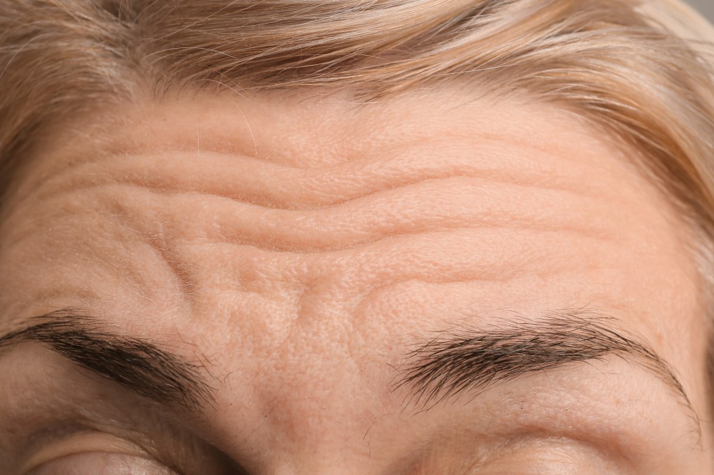 Mature woman close up of forehead wrinkles