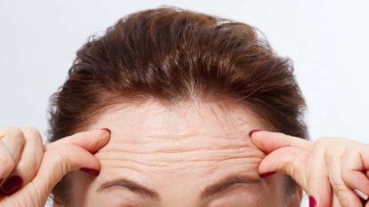 Woman with wrinkles on her forehead