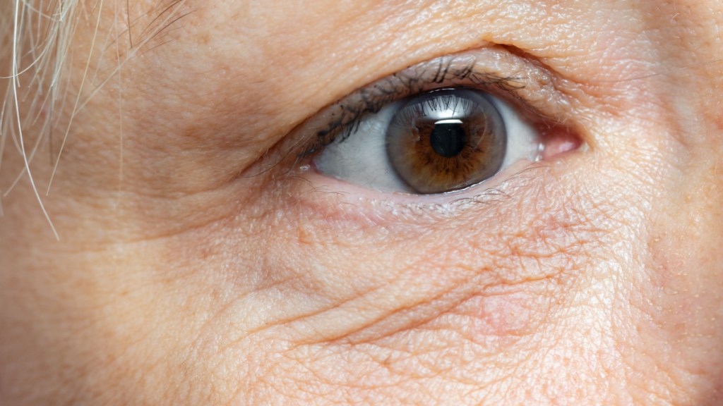 Göz Altı Kırışıklıklarını ve Yaşlanma Belirtilerini Azaltmak İçin Profesyonel İpuçları