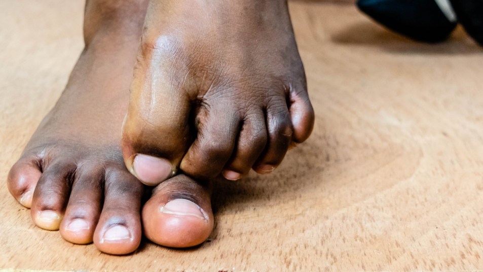 bare feet with cut toenails