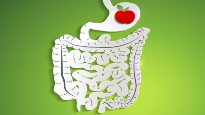 Apple in human stomach
