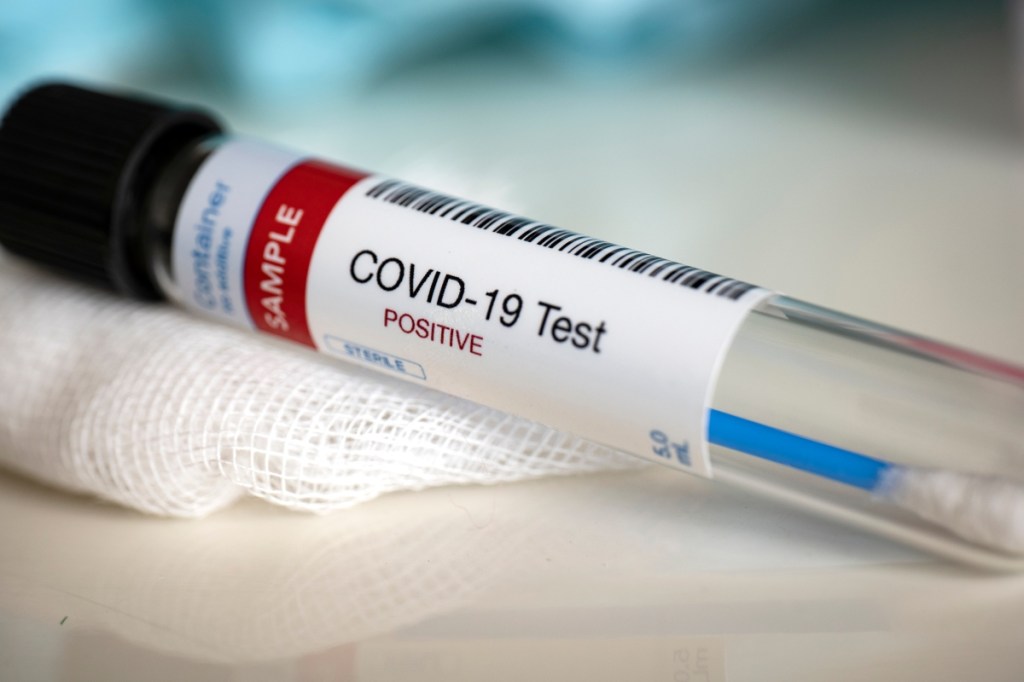 Perşembe Ücretsiz COVID Testleri İçin Son Çağrı