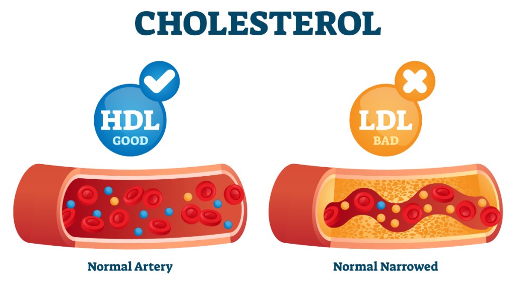 An illustration of HDL and LDL cholesterol, which impacts heart disease in women