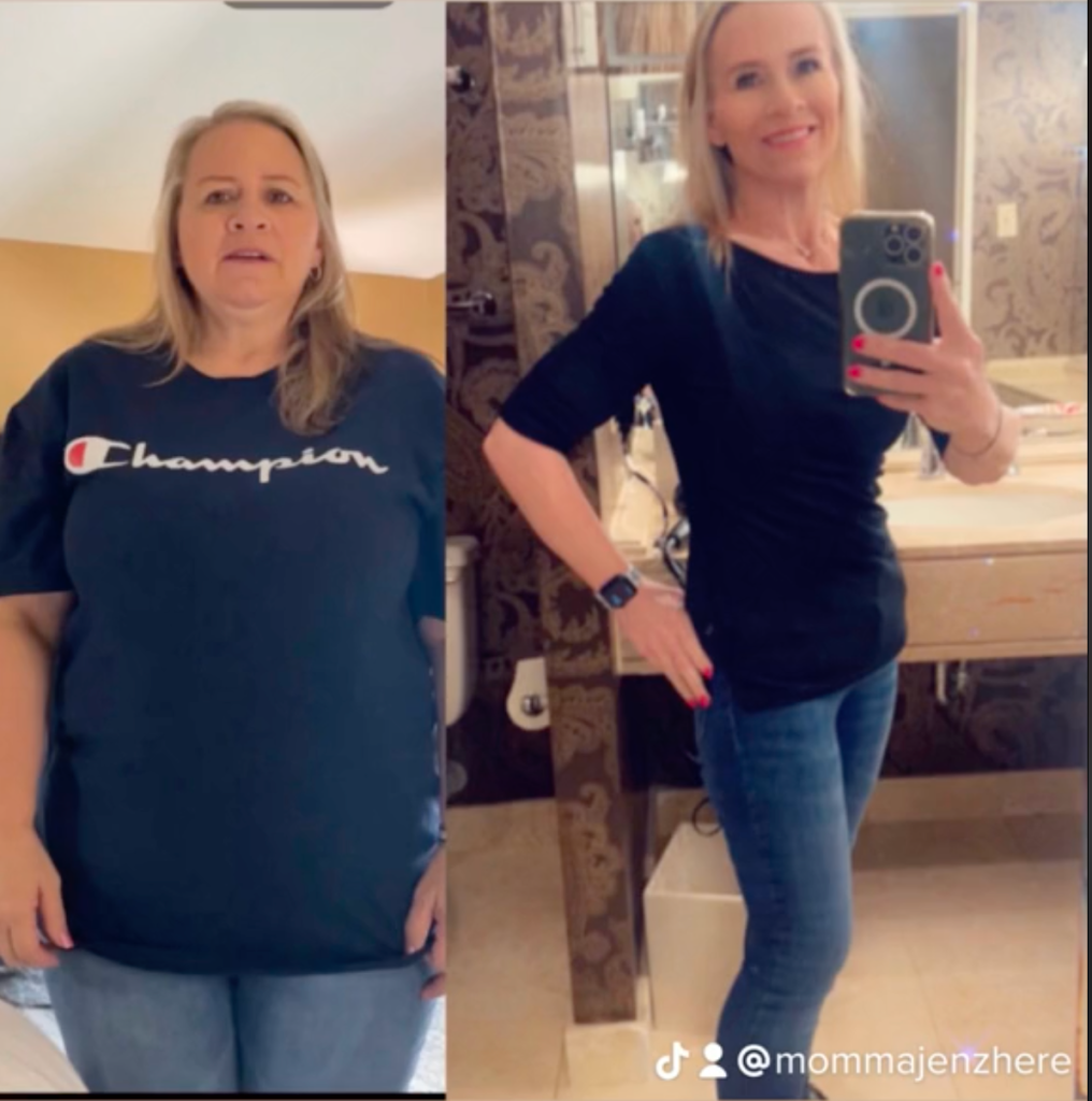 Before and after of Jen Witherspoon who lost 103 lbs with the help of cottage cheese