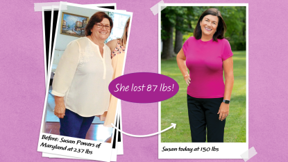 Before and after shots of Susan Powers who relied on a weight loss tea to lose 80 lbs