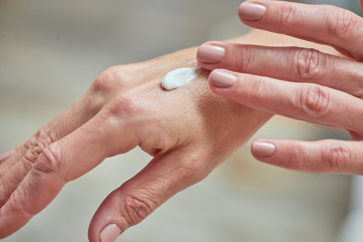 woman applying arnica hand cream for bruises