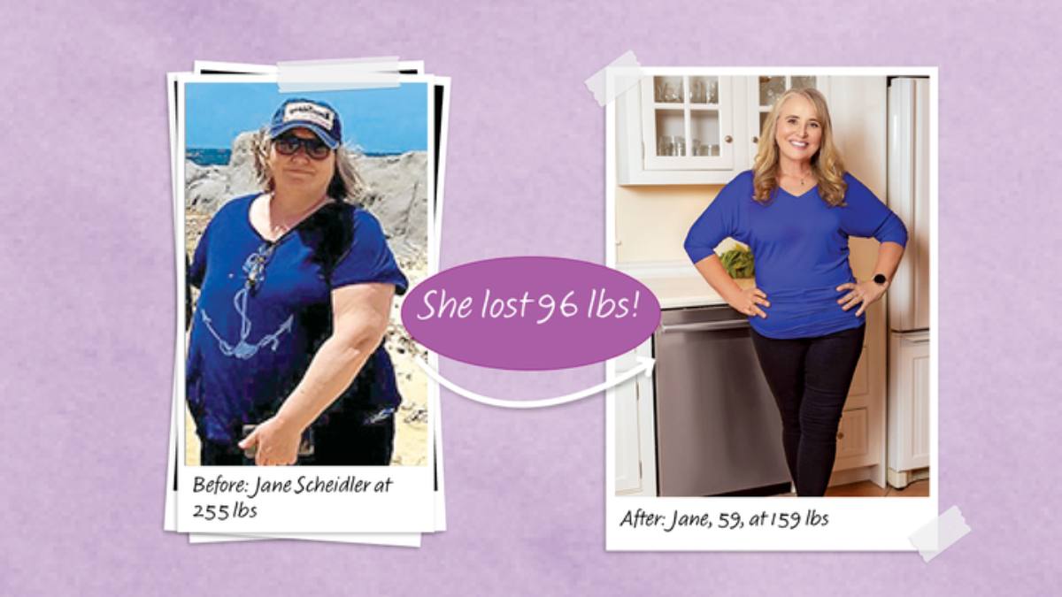 Jane Before and After