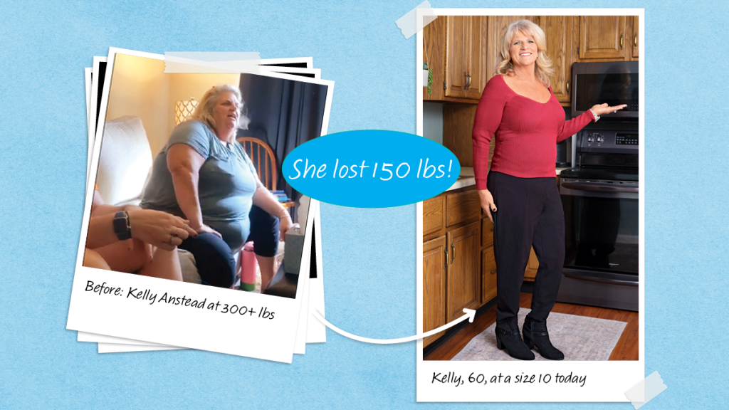 Before and after of Kelly Anstead who dropped 150 lbs with the help of eggs for weight loss