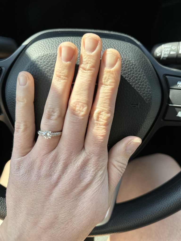 A pre-manicured hand.