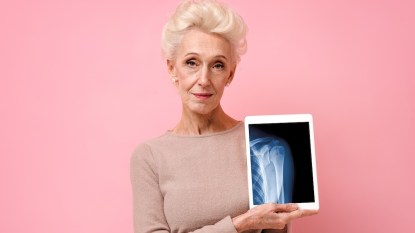 Woman holding x-ray by shoulder